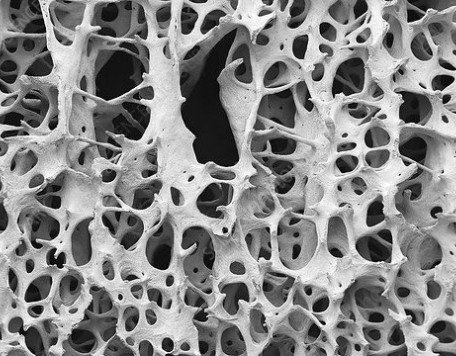 C0293239 Bone tissue SEM