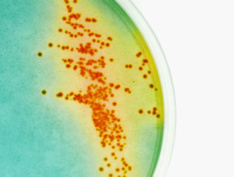Tech 29 Bacteria Colonies